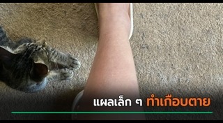 ติดเชื้อในกระแสเลือด