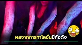 โลชั่นทาผิว