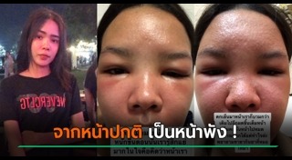 ครีมผิวขาว