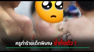 เด็กพิเศษ