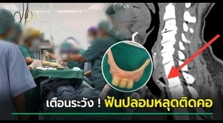 ฟันปลอม