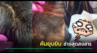 เหา