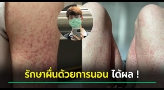 พักผ่อนไม่พอ