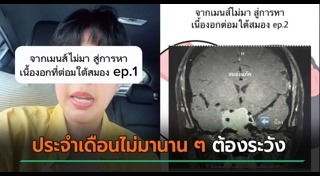 เนื้องอก
