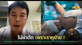 ผ่าตัดสมอง