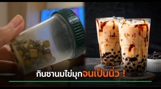 นิ่วในถุงน้ำดี