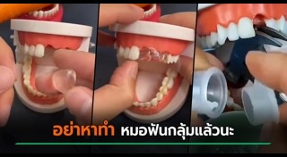 ฟันปลอม