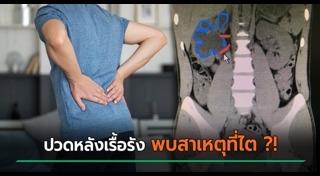 ปวดหลัง