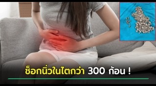 นิ่วในไต