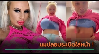 ศัลยกรรมหน้าอก