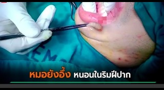 ปรสิต