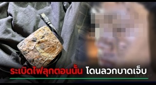 แบตเตอรี่ระเบิด