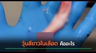 วัคซีนโควิด 19