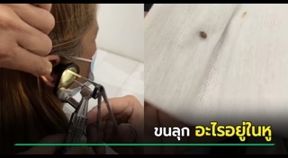เห็บหมัด