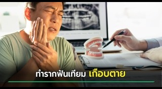 รากฟันเทียม