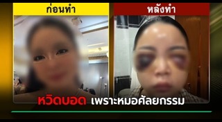 ศัลยกรรมตา