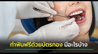 ทำฟันฟรี