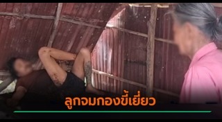 โรคจิตเวช