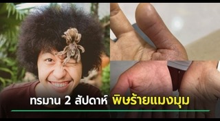 แมงมุมทารันทูล่า