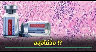 วัคซีนโควิด 19