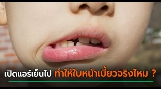โรคอัมพาตครึ่งใบหน้า