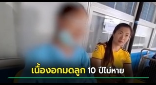 เนื้องอก