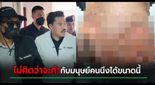 นายจ้างทำร้ายลูกจ้าง