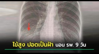 ปอดติดเชื้อ