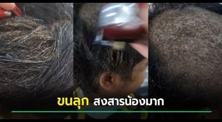 เหา