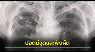 น้ำประปา