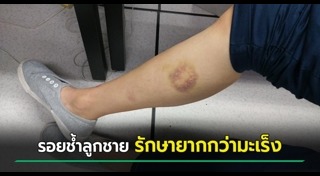 สัญญาณเตือนสุขภาพ