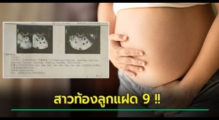 ตั้งครรภ์แฝด