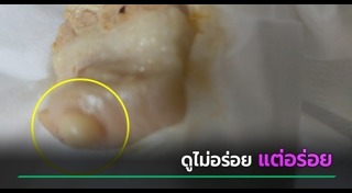 เนื้อหมู