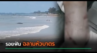 ฉลามกัดคน