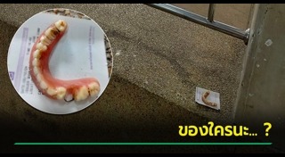 ฟันปลอม