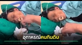 พยาธิตัวตืด