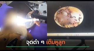 เห็บหมัด