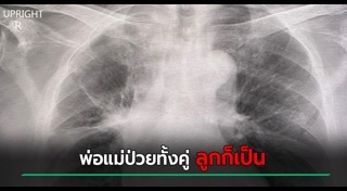 มะเร็งปอด