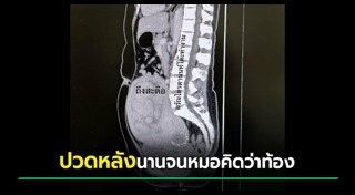 เนื้องอก