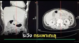 เตือนภัยผู้บริโภค