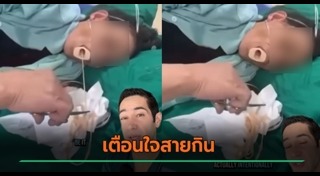 พยาธิตัวตืด