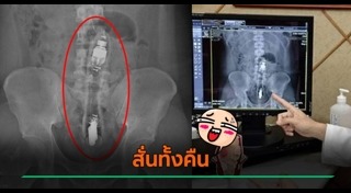 เล่นพิเรนทร์