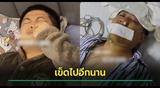 เลือดกำเดา