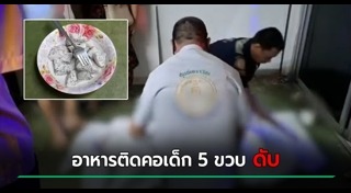 สำลักอาหาร