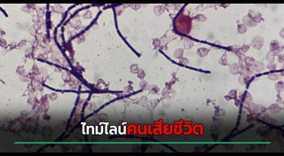 แอนแทรกซ์