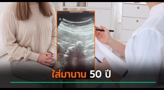 ตกขาว