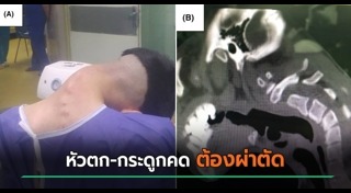 ป่วยแปลก