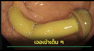 เห็ดเข็มทอง