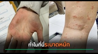 โรคติดต่อทางเพศสัมพันธ์