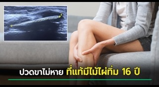 ป่วยแปลก